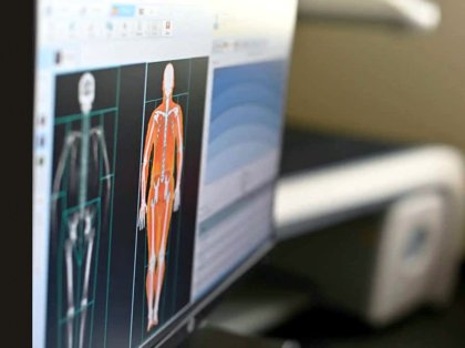 Efectividad Densitometría Ósea